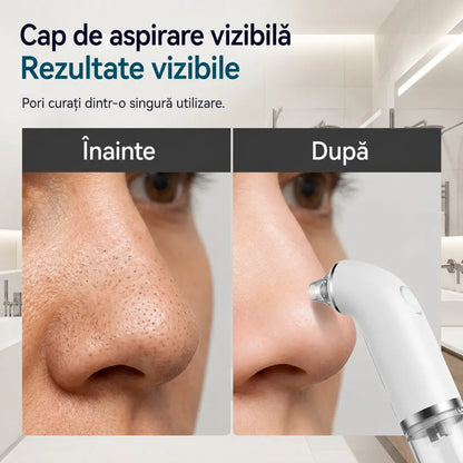 Dispozitiv electric pentru curățarea feței · Fermitate și lifting · Curățare profundă a porilor